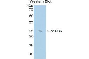 Detection of Recombinant IL33, Mouse using Polyclonal Antibody to Interleukin 33 (IL33) (IL-33 antibody  (AA 109-266))