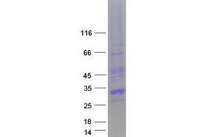 Validation with Western Blot (CITED1 Protein (Transcript Variant 1) (Myc-DYKDDDDK Tag))