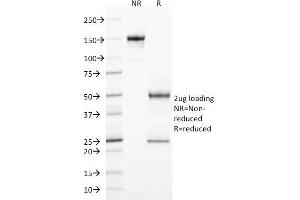 SDS-PAGE Analysis Purified CD103 Mouse Monoclonal Antibody (ITGAE/2474).