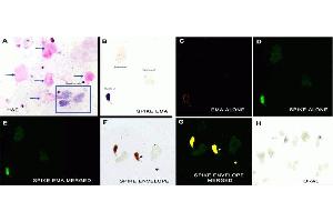 Immunohistochemistry (IHC) image for anti-SARS-CoV-2 Spike (C-Term) antibody (ABIN1030641)