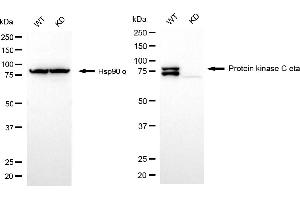 Western blotting analysis using protein kinase C eta antibody (ABIN7799997).