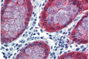 Colon, Human: Formalin-Fixed, Paraffin-Embedded (FFPE) (HOXC8 antibody  (AA 35-84))