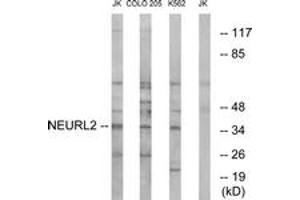 Western blot analysis of extracts from Jurkat/COLO/K562 cells, using NEURL2 Antibody. (NEURL2 antibody  (AA 99-148))
