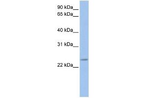 WB Suggested Anti-FKBP3 Antibody Titration: 0. (FKBP3 antibody  (C-Term))