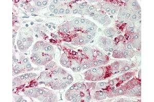 Formalin-fixed and paraffin-embedded H. (GALNT9 antibody  (AA 296-322))