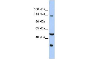 WB Suggested Anti-WDHD1 Antibody Titration: 0. (WDHD1 antibody  (C-Term))