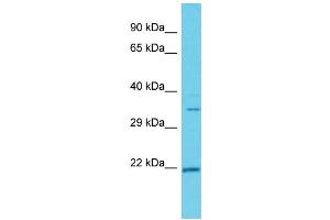 Host: Rabbit  Target Name: Hmgcl  Sample Tissue: Rat Thymus lysates  Antibody Dilution: 1. (HMGCL antibody  (C-Term))