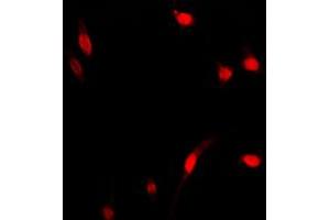 Immunofluorescent analysis of NF-kappaB p65 staining in MCF7 cells. (NF-kB p65 antibody  (Center))