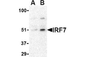 Image no. 1 for anti-Interferon Regulatory Factor 7 (IRF7) (Middle Region) antibody (ABIN265130) (IRF7 antibody  (Middle Region))