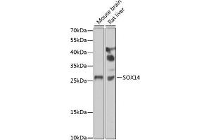 Western blot analysis of extracts of various cell lines, using SOX14 antibody (ABIN6130912, ABIN6148291, ABIN6148293 and ABIN6223049) at 1:1000 dilution. (SOX14 antibody  (AA 91-240))