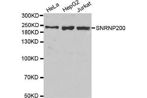 Western Blotting (WB) image for anti-Small Nuclear Ribonucleoprotein 200kDa (U5) (SNRNP200) antibody (ABIN1877090) (SNRNP200 antibody)
