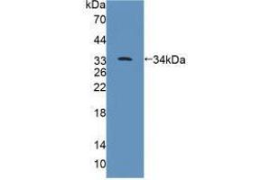 Western blot analysis of recombinant Rat PTPRB. (PTPRB antibody  (AA 1041-1310))