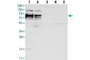 Western blot analysis of Lane 1: RT-4, Lane 2: U-251 MG, Lane 3: Human Plasma, Lane 4: Liver, Lane 5: Tonsil with HS6ST2 polyclonal antibody  at 1:250-1:500 dilution. (HS6ST2 antibody)