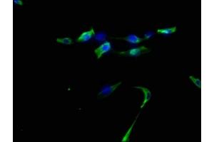 Immunofluorescence staining of U87 cells with ABIN7139803 at 1:50, counter-stained with DAPI.