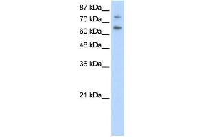 WB Suggested Anti-ZSCAN2 Antibody Titration:  0. (ZSCAN2 antibody  (N-Term))