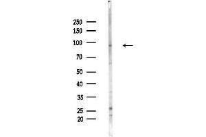 Western blot analysis of lysates from LoVo cells(heat-shock,45 min treatment), using RBM5 Antibody at 1/1000 dilution.