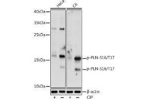 Western blot analysis of extracts of various cell lines, using Phospho-PLN-S16/T17 antibody (ABIN7269330) at 1:1000 dilution. (Phospholamban antibody  (pSer16, pThr17))