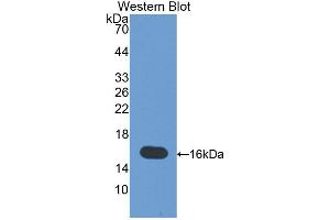 Figure. (MIA antibody  (AA 23-130))