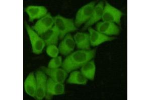 Immunocytochemistry (ICC) image for anti-Fatty Acid Synthase (FASN) antibody (ABIN4953251)