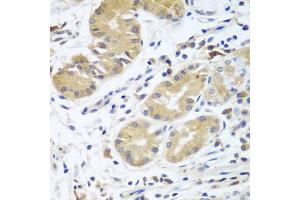 Immunohistochemistry of paraffin-embedded human stomach using CFD antibody (ABIN5974492) at dilution of 1/100 (40x lens). (Adipsin antibody)