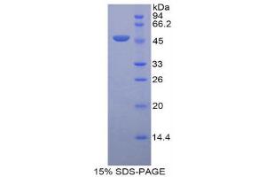 SDS-PAGE (SDS) image for Leucine-Rich alpha-2 Glycoprotein 1 (LRG1) (AA 154-332) protein (His tag,GST tag) (ABIN2123160)