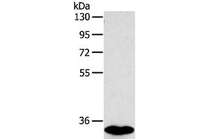 Western Blot analysis of Human fetal intestines tissue using SULT1B1 Polyclonal Antibody at dilution of 1:800 (SULT1B1 antibody)