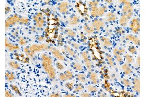 ABIN6264110 and ABIN6273291 at 1/100 staining Rat kidney tissue by IHC-P. (PDHB antibody  (N-Term))