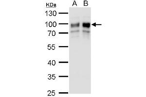 WB Image GOLPH2 antibody detects GOLPH2 protein by western blot analysis. (GOLM1 antibody  (C-Term))