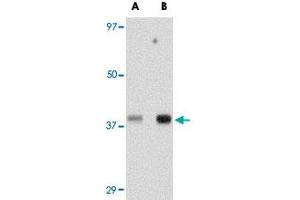 Western blot analysis of TREX1 in human spleen tissue lysate with TREX1 polyclonal antibody  at (A) 0. (TREX1 antibody  (Internal Region))