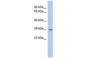 Image no. 1 for anti-Enoyl CoA Hydratase Domain Containing 2 (ECHDC2) (AA 143-192) antibody (ABIN6743494) (ECHDC2 antibody  (AA 143-192))