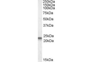 Image no. 2 for anti-Caveolin 3 (CAV3) (N-Term) antibody (ABIN375161) (Caveolin 3 antibody  (N-Term))