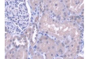 DAB staining on IHC-P; Samples: Human Kidney Tissue (Cathepsin H antibody  (AA 23-335))