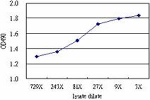 SERPINA3 (Human) Matched Antibody Pair