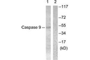 Western blot analysis of extracts from 293 cells, treated with Calyculin 50nM 30', using Caspase 9 (Ab-196) Antibody.