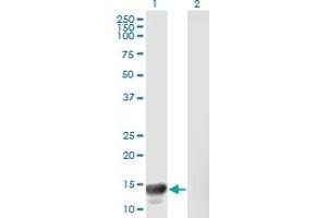 Western Blot analysis of MACF1 expression in transfected 293T cell line by MACF1 monoclonal antibody (M08), clone 1G9. (MACF1 antibody  (AA 1-95))