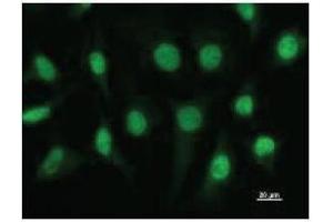 Immunostaining analysis in HeLa cells. (ETV3 antibody)