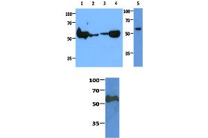 anti-Pyruvate Kinase M1/2 (PKM) (AA 1-531) antibody