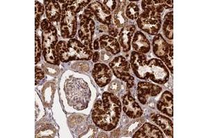 Immunohistochemical staining of human kidney with KRT78 polyclonal antibody  shows strong granular cytoplasmic positivity in cells in renal tubules.