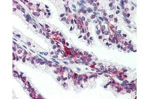 Anti-SLC39A6 antibody IHC of human prostate. (SLC39A6 antibody  (Internal Region))