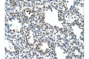 Immunohistochemistry (IHC) image for anti-Naked Cuticle Homolog 1 (NKD1) (N-Term) antibody (ABIN310131) (NKD1 antibody  (N-Term))