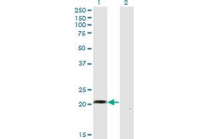 Western Blot analysis of WISP2 expression in transfected 293T cell line by WISP2 monoclonal antibody (M02), clone 1E11. (WISP2 antibody  (AA 24-250))