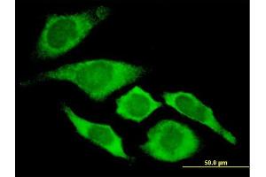 Immunofluorescence of monoclonal antibody to CDKN1A on HeLa cell. (p21 antibody  (AA 65-164))