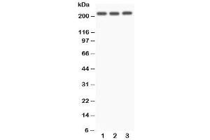 Western blot testing of NOTCH4 antibody and Lane 1:  A549 (NOTCH4 antibody  (C-Term))