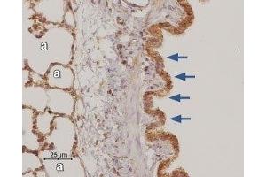 Expression of Adenosine A3 Receptor in rat lung - Immunohistochemical staining of paraffin-embedded rat lung sections using Anti-Adenosine A3 Receptor Antibody (ABIN7042891, ABIN7043892 and ABIN7043893), (1:50). (Adenosine A3 Receptor antibody  (3rd Intracellular Loop))