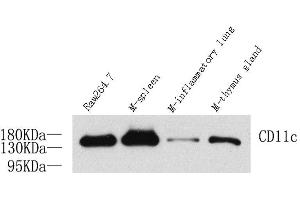 Western Blot analysis of various samples using ITGAX Polyclonal Antibody at dilution of 1:1000. (CD11c antibody)