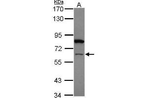 WB Image Sample (20 ug) A: HeLa nucleus 7. (ZNF449 antibody)