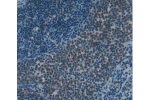 #VALUE! (Signaling Lymphocytic Activation Molecule Family, Member 2 (AA 27-243) antibody)