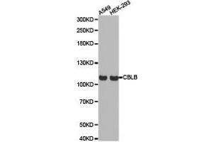 Western Blotting (WB) image for anti-Cbl Proto-Oncogene B, E3 Ubiquitin Protein Ligase (CBLB) antibody (ABIN1871488) (Cbl Proto-Oncogene B, E3 Ubiquitin Protein Ligase (CBLB) antibody)