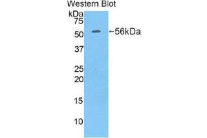 Western Blotting (WB) image for anti-Ribophorin 1 (RPN1) (AA 273-518) antibody (ABIN1860469) (RPN1 antibody  (AA 273-518))