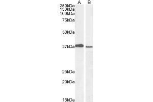 ABIN184999 staining (1µg/ml) of A549 (A) and PD19 (B) cell lysate (RIPA buffer, 30µg total protein per lane).